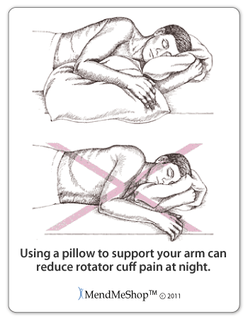 Supporting your arm while you sleep can reduce the tear on your rotator cuff and the pain during the night.