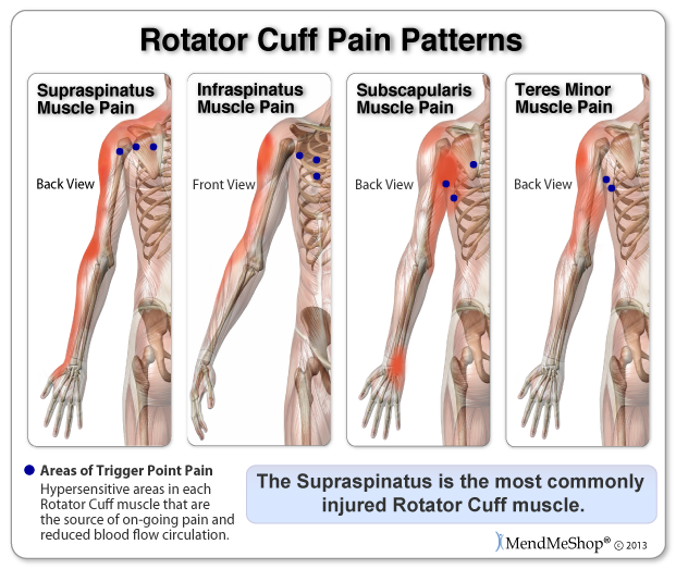 How to relieve pain deals from a torn rotator cuff