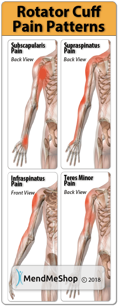 Rotator cuff on sale strain symptoms