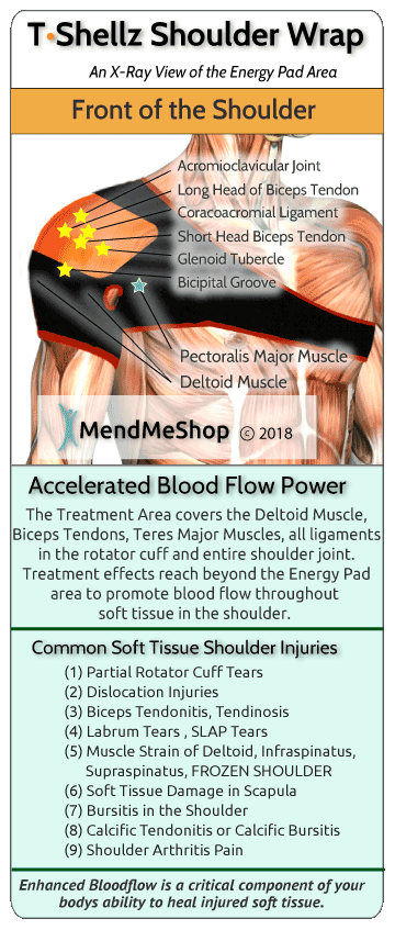 Improved localized circulation with a T•Shellz Wrap during tendonitis recovery